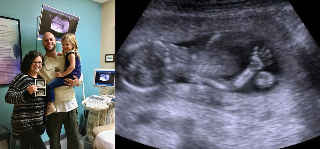 Pregnany Care Center of the North Coast New Facility Renovation